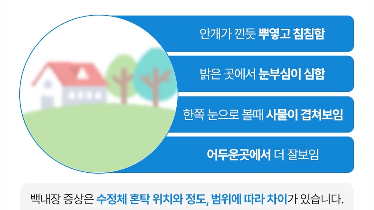 백내장의 대표 증상 네 가지를 정리한 안내 카드