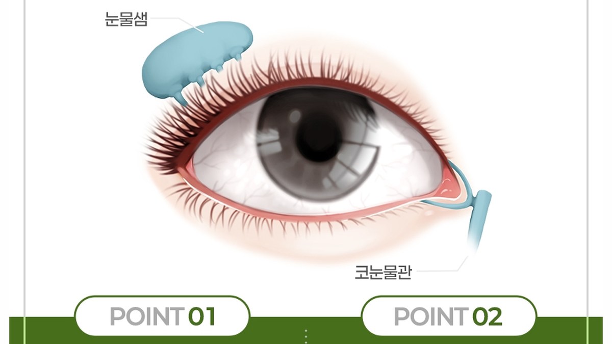 눈 단면 그림과 함께 눈물흘림증이 생기는 원인 두 가지를 정리한 카드