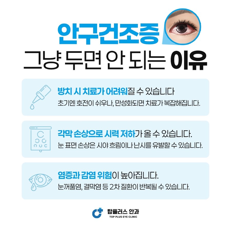 안구건조증을