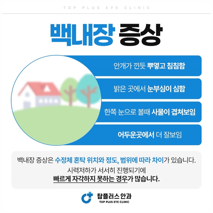 백내장의 대표 증상