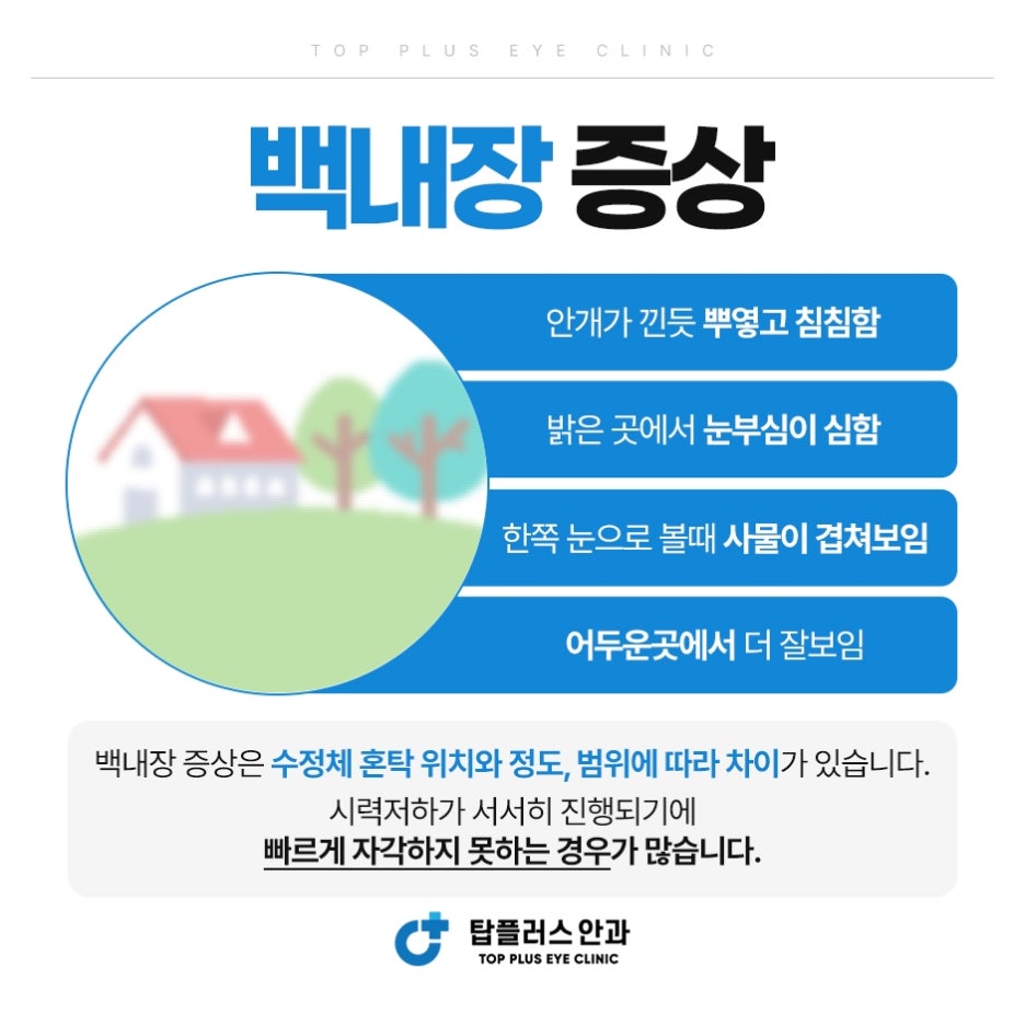 백내장 증상