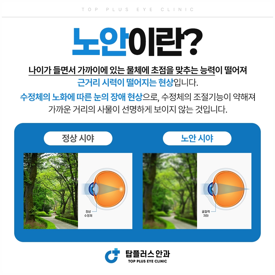노안 시야비교