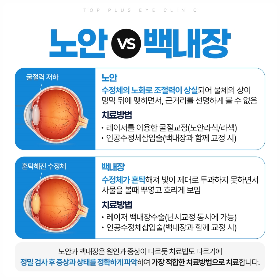 노안 VS 백내장