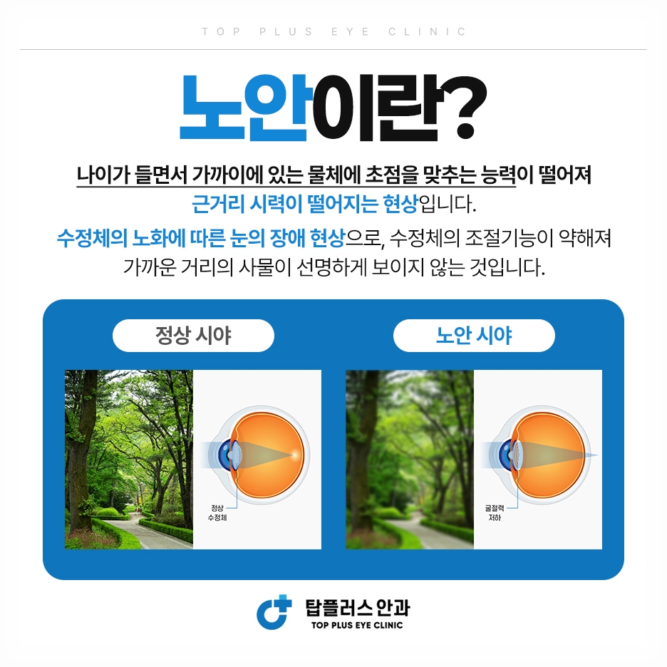 노안 시야비교
