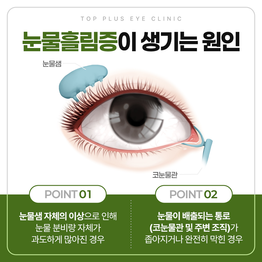 눈물샘 코눈물관