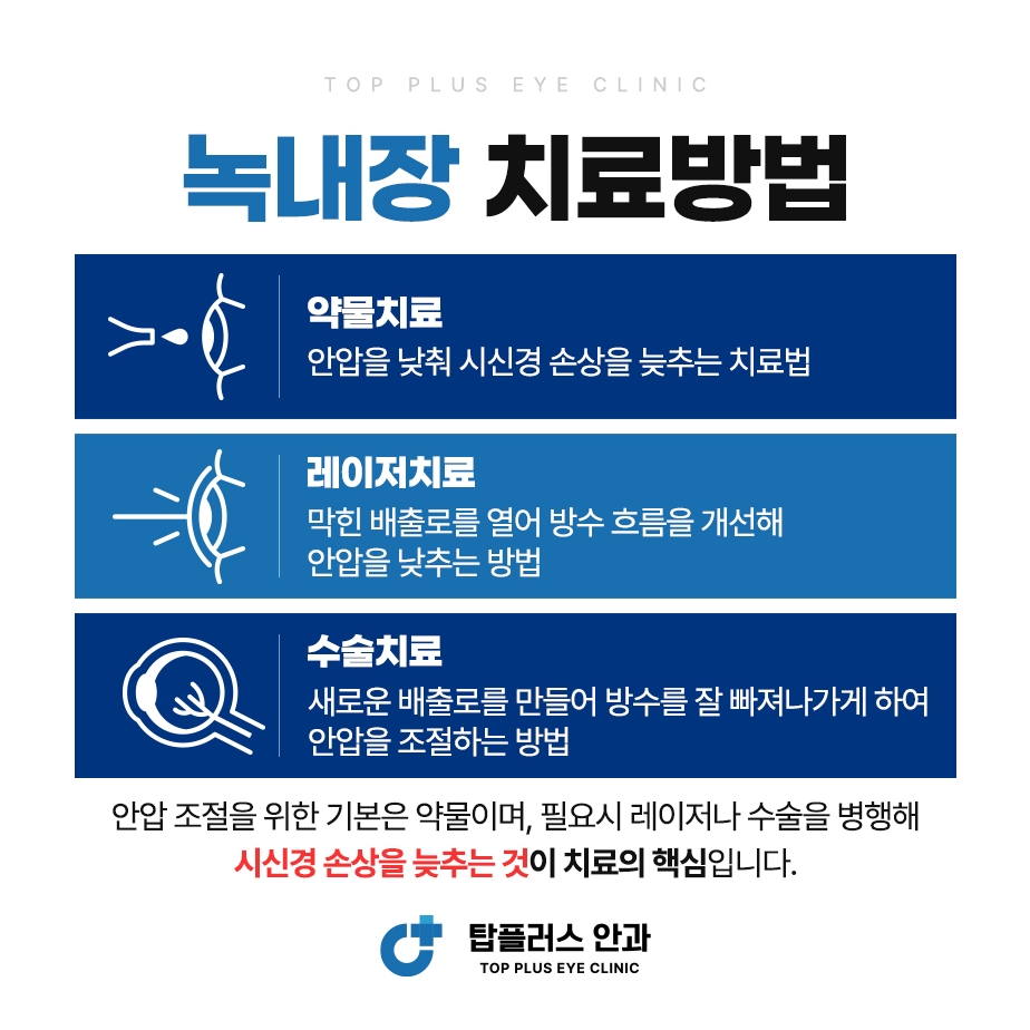 녹내장 안내 카드