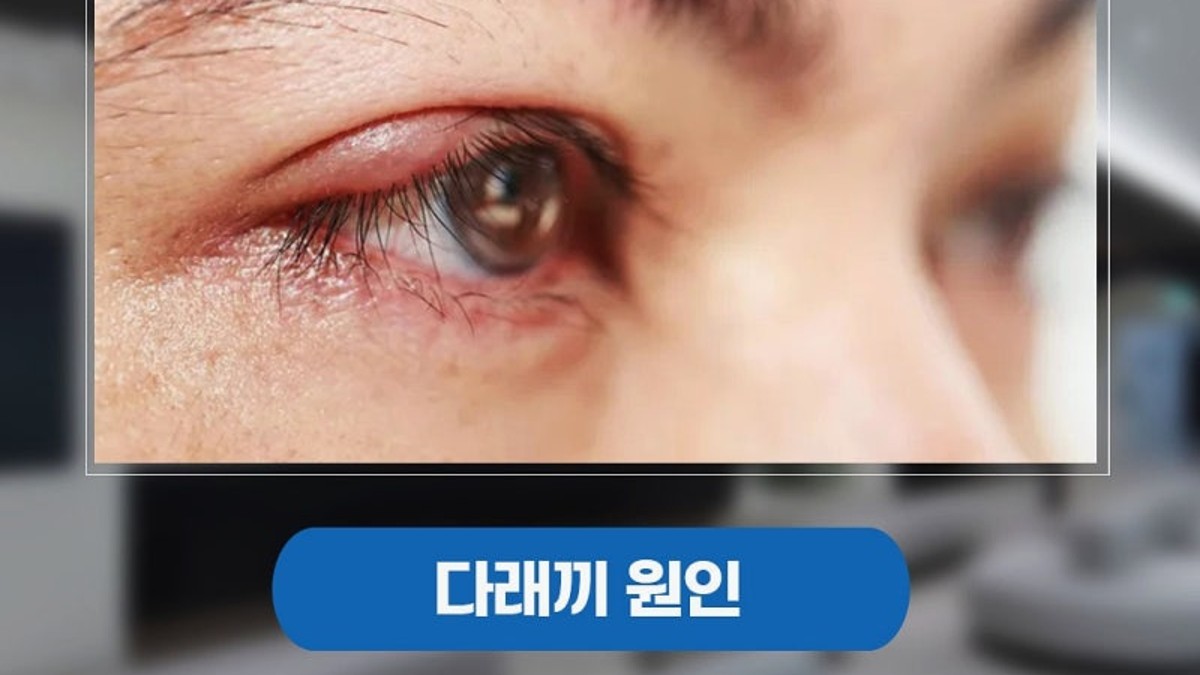 상담 장면